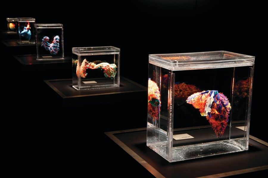 Las Vegas: BODIES | The Exhibition at the Luxor - What you see inside the Luxor exhibition